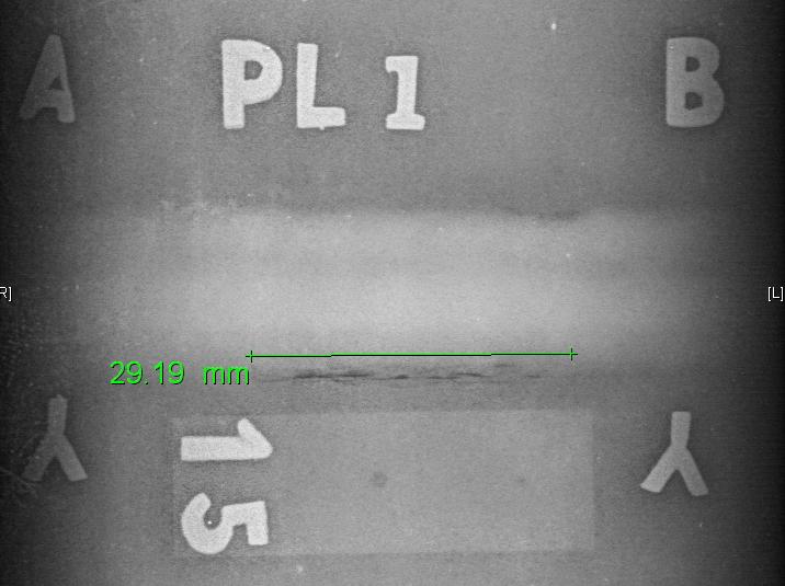 Computed Radiography (CR)